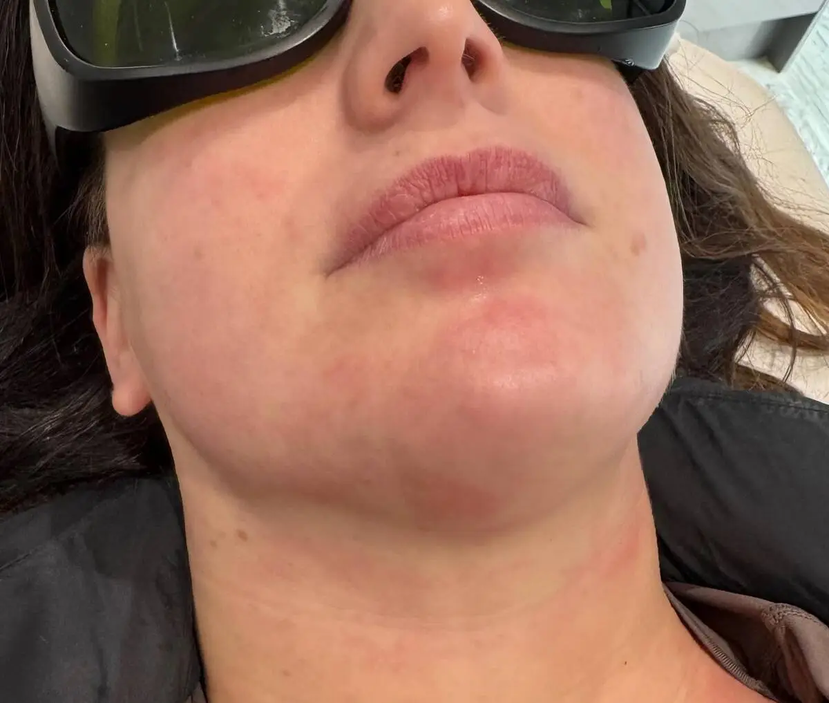 Professional nail treatment